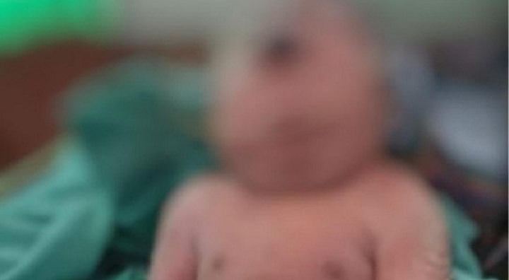 Kisah Haru! Bayi Lahir Tanpa Hidung dan Bermata Satu di Wawonii