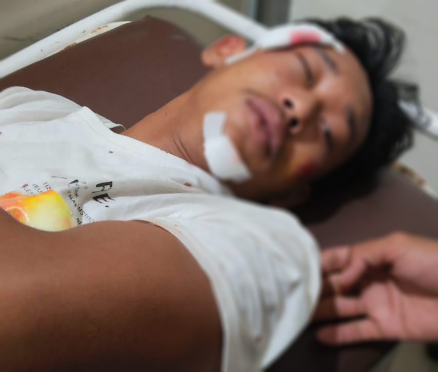 Diduga Dipukuli Oleh Anak Salahseorang RT, Korban Desak Polisi Bertindak Cepat