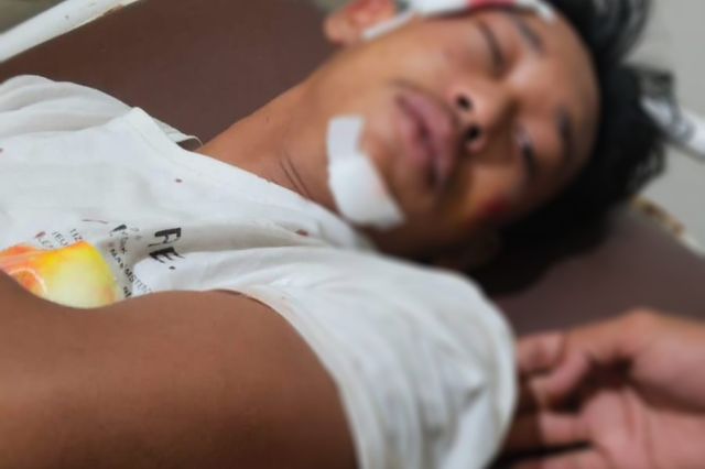 Diduga Dipukuli Oleh Anak Salahseorang RT, Korban Desak Polisi Bertindak Cepat